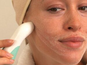 maquina microdermabrasion rio crystalrenew frontal
